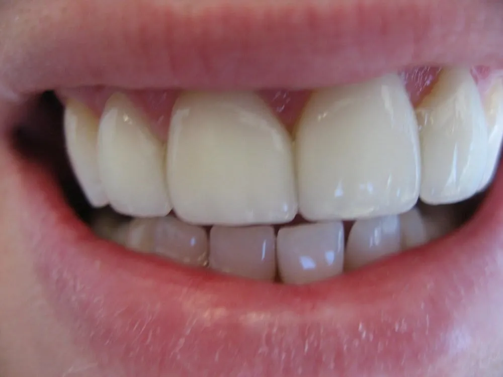 Slide of NV Radiators